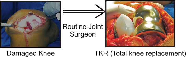 Routine joint surgery